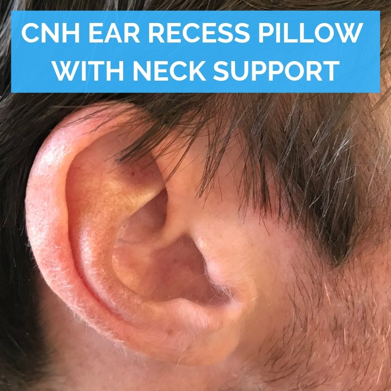 Chondrodermatitis nodularis chronica helicis (CNH) ear recess pillow with neck support | Putnams